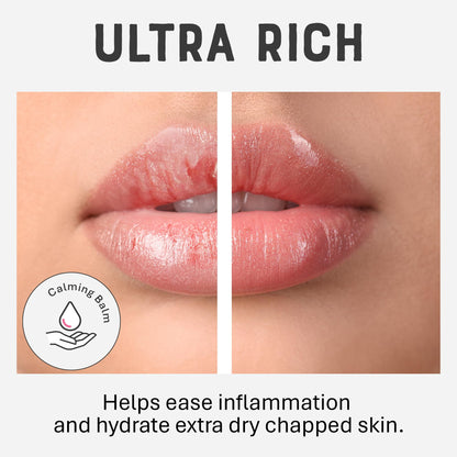 Dr. Lipp CBD Calm Balm 0.27 fl oz / 8ml – 5-in-ONE Multi-Use Ultra Moisturising Lip Balm for Extra Dry Chapped Lips & Bits – With 50mg Cannabidiol & 100% Natural Lanolin – Fragrance & Cruelty Free